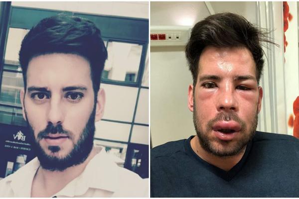 HOROR! ŽELJKU STOJANOVIĆU PROMENJEN LIČNI OPIS: Pogledajte na šta liči rijaliti zvezda SADA!