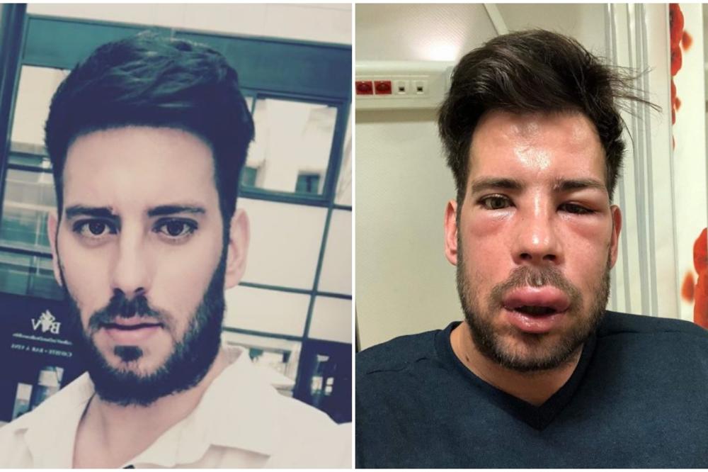 HOROR! ŽELJKU STOJANOVIĆU PROMENJEN LIČNI OPIS: Pogledajte na šta liči rijaliti zvezda SADA!