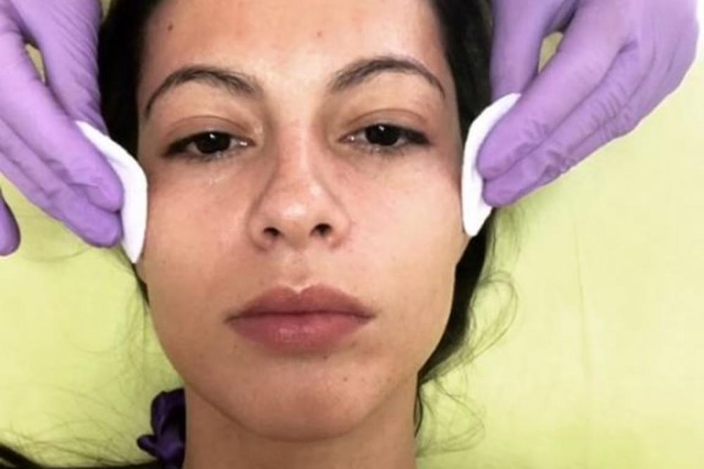 PRELEPA SRPSKA VODITELJKA U RASPADNUTOM STANJU NAKON KORONE! Prvi put je uspela da se okupa, OVO JE JEZIVO! (FOTO)