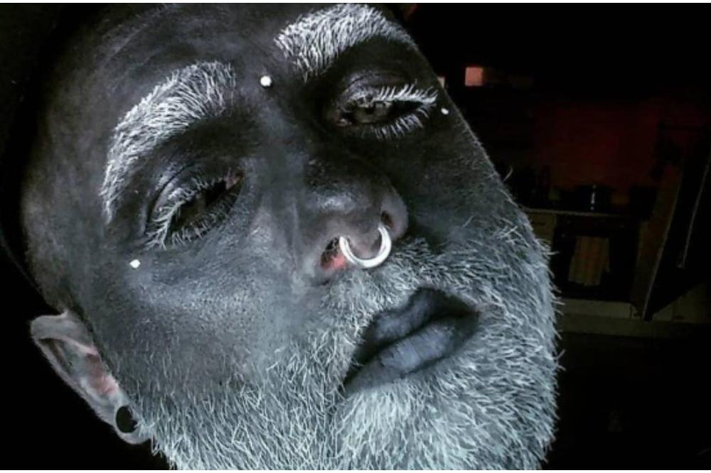 Adam želi da ODSTRANI svoj POLNI ORGAN, jer mu uništava izgled! Neke delove tela je već UKLONIO! (FOTO)