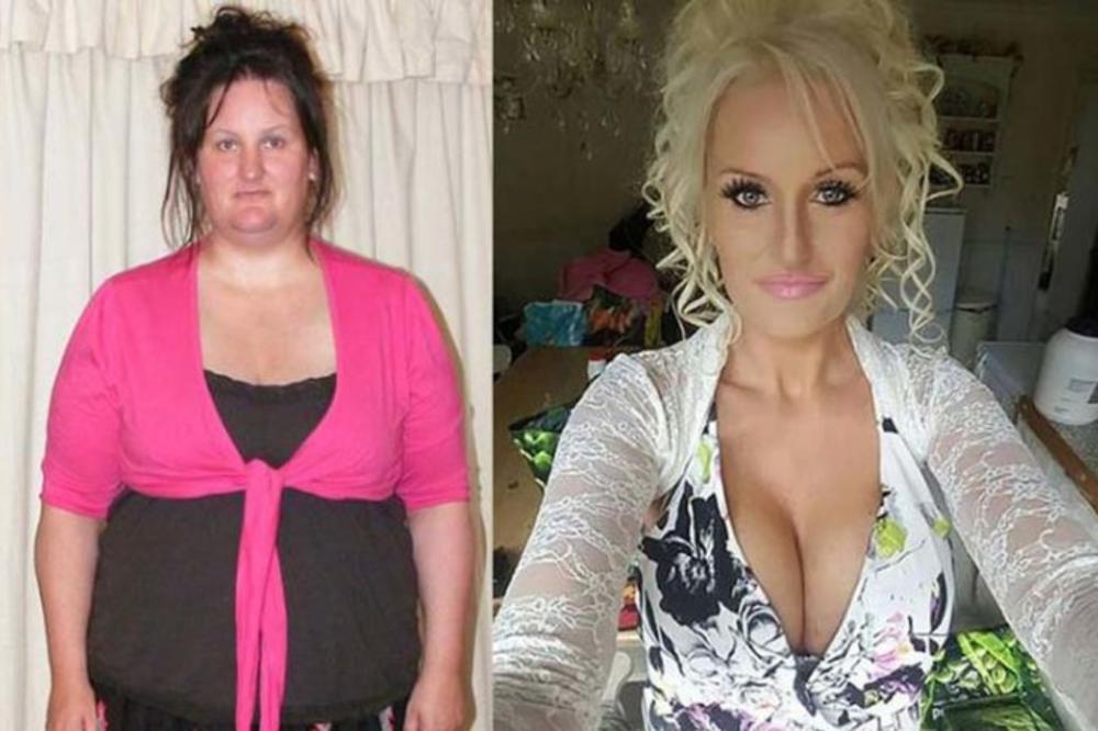 NA OVE DVE SLIKE JE ISTA ŽENA! Doživela je neverovatnu TRANSFORMACIJU i smršala 90 kilograma, a evo kako je to uspela! (FOTO)