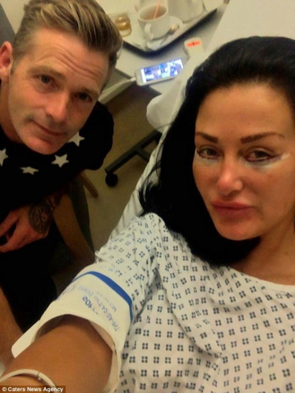 Sa 25 godina je prvi put išla na tretman botoksom  