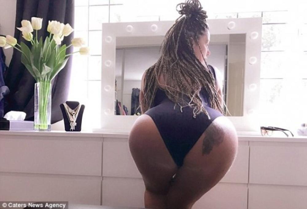 Njena zadnjica je toliko velika da ne može da sedne u avionsko sedište  