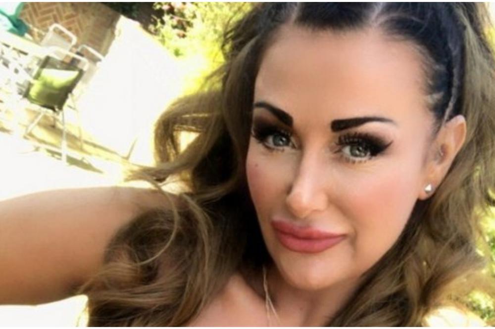 SA 25 GODINA IMALA JE PRVU PLASTIČNU OPERACIJU: Ova žena je zavisnik OD ESTETSKE HIRURGIJE i ima TOLIKU ZADNJICU da ne može da sedne u avionsko sedište (FOTO)