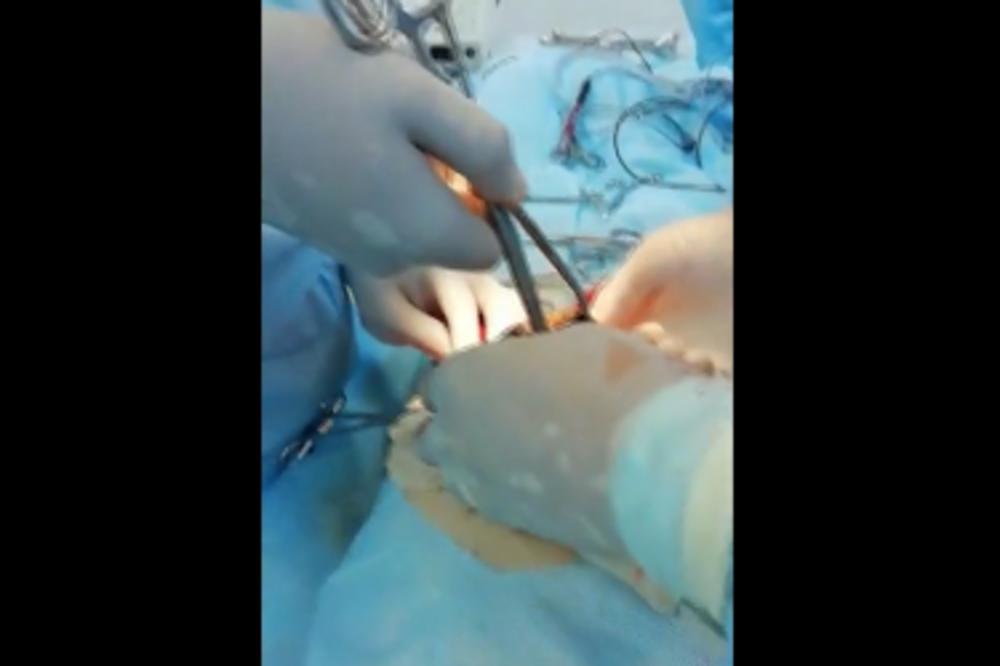 DEVOJČICA (12) JE DRASTIČNO SMRŠALA, ALI JOJ JE STOMAK PORASTAO: Lekari su joj zatim na ULTRAZVUKU otkrili nešto JEZIVO! (VIDEO)