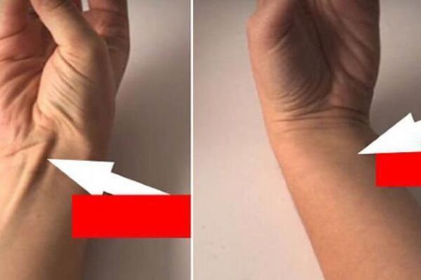 SPOJITE PALAC I MALI PRST: Ako se pojavi IZBOČINA, to znači samo JEDNU stvar! (FOTO)