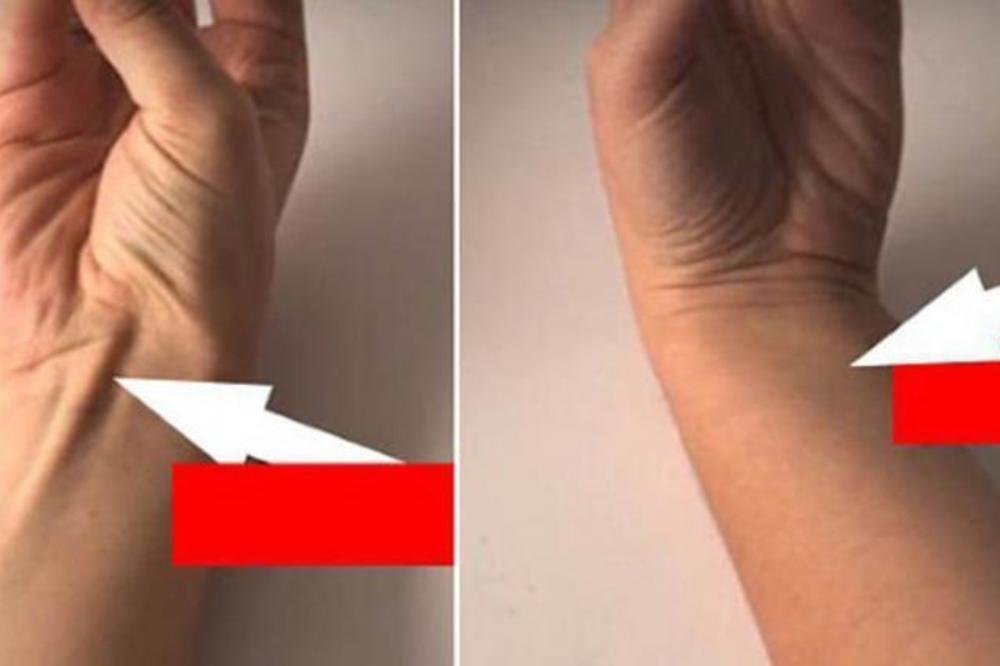 SPOJITE PALAC I MALI PRST: Ako se pojavi IZBOČINA, to znači samo JEDNU stvar! (FOTO)