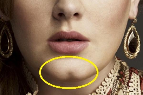 IMATE LI RUPICU NA BRADI? Iznenadićete se kada čujete šta to govori o vama i vašoj skrivenoj ličnosti!