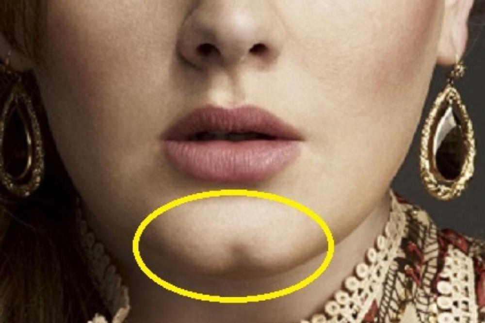 IMATE LI RUPICU NA BRADI? Iznenadićete se kada čujete šta to govori o vama i vašoj skrivenoj ličnosti!