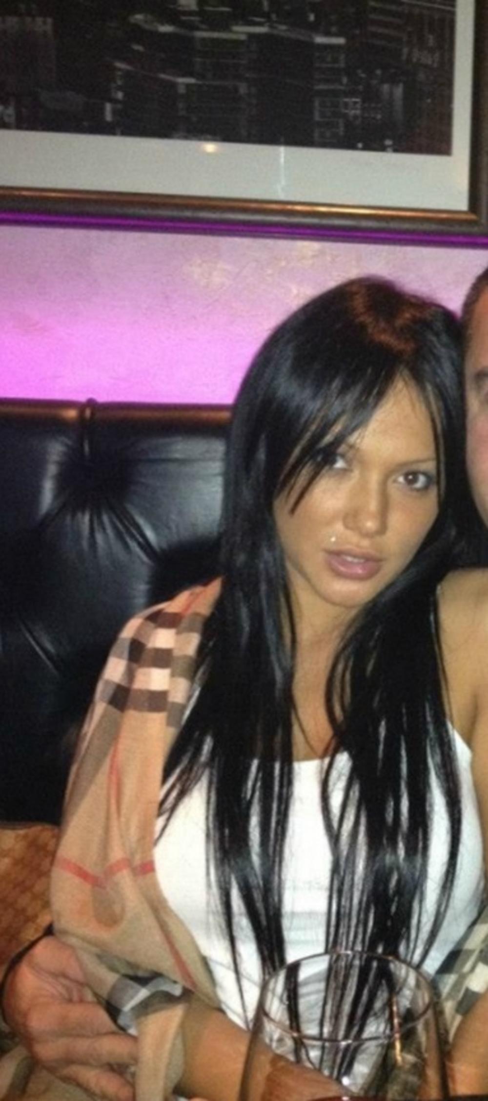 Tamara pre estetskih zahvata  