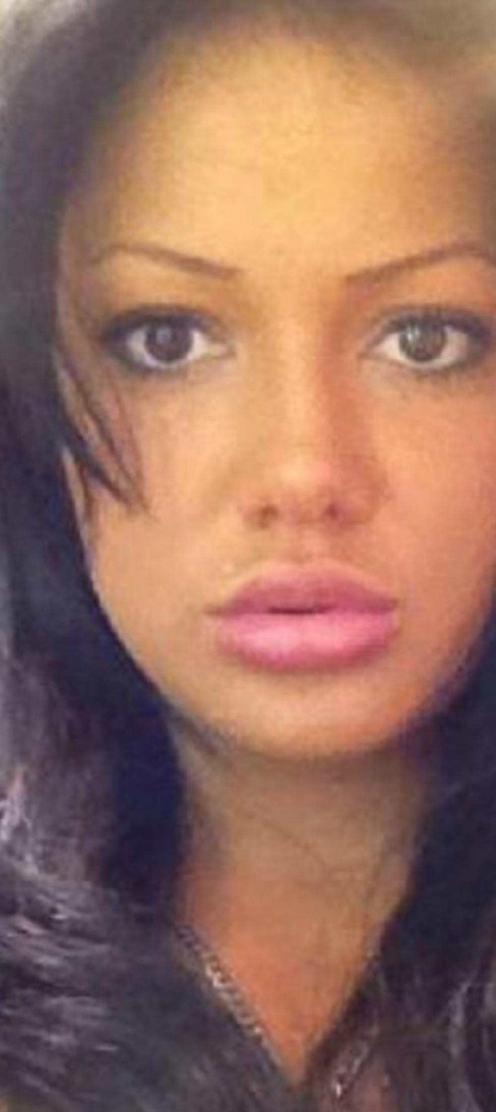 Tamara pre estetskih zahvata  