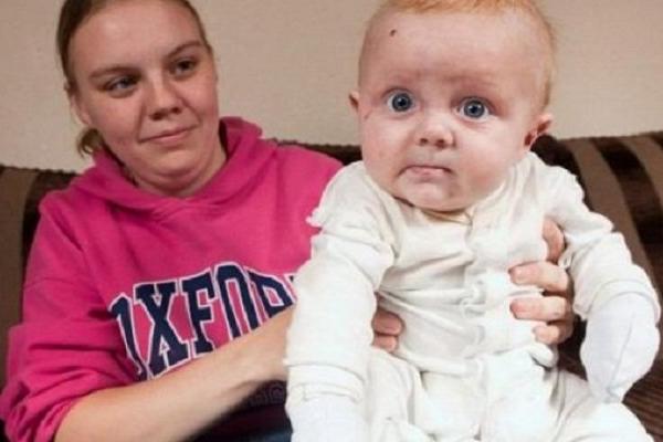 NJEGOVA KOŽA PUCA POD MOJIM RUKAMA! Ova majka ne može da zagrli svoje dete: Svaki put kad ga dodirne nastaju OVE MUKE! (FOTO)