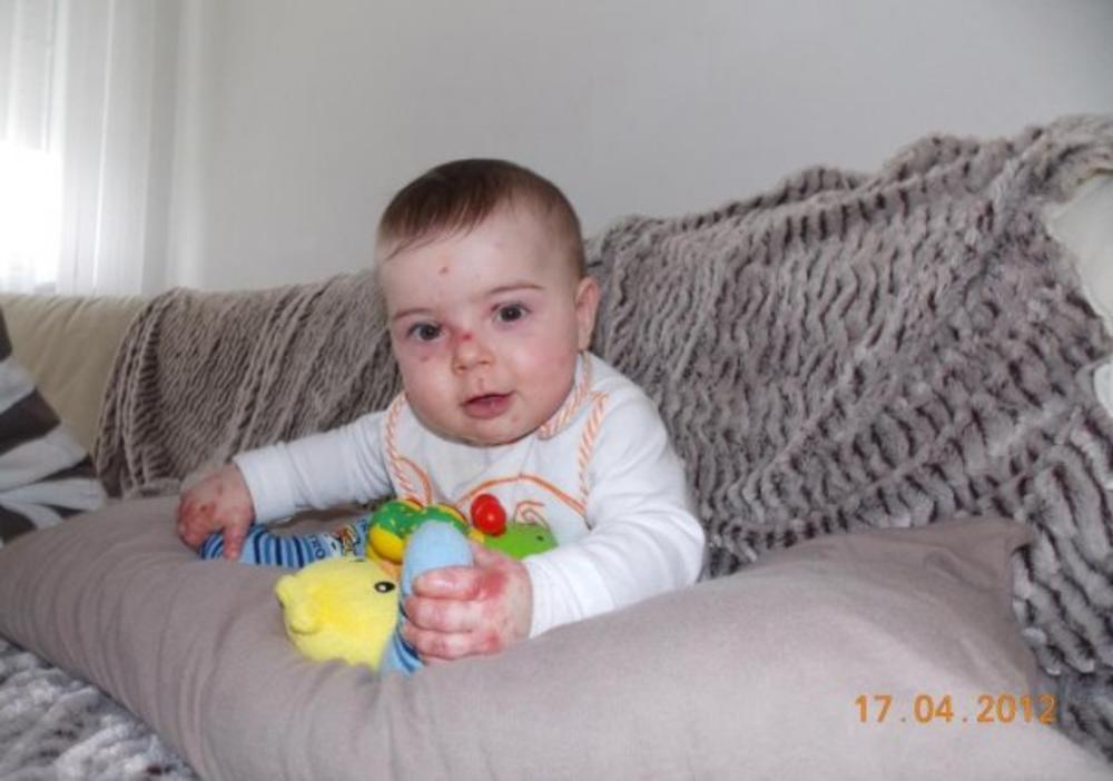 Njen sin ima teško oboljenje  