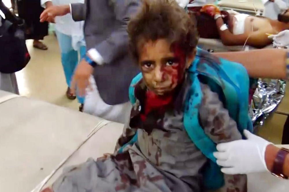 MASAKR NAD DECOM U JEMENU: U napadu saudijske koalicije UBIJENO 29 MALIŠANA (VIDEO)
