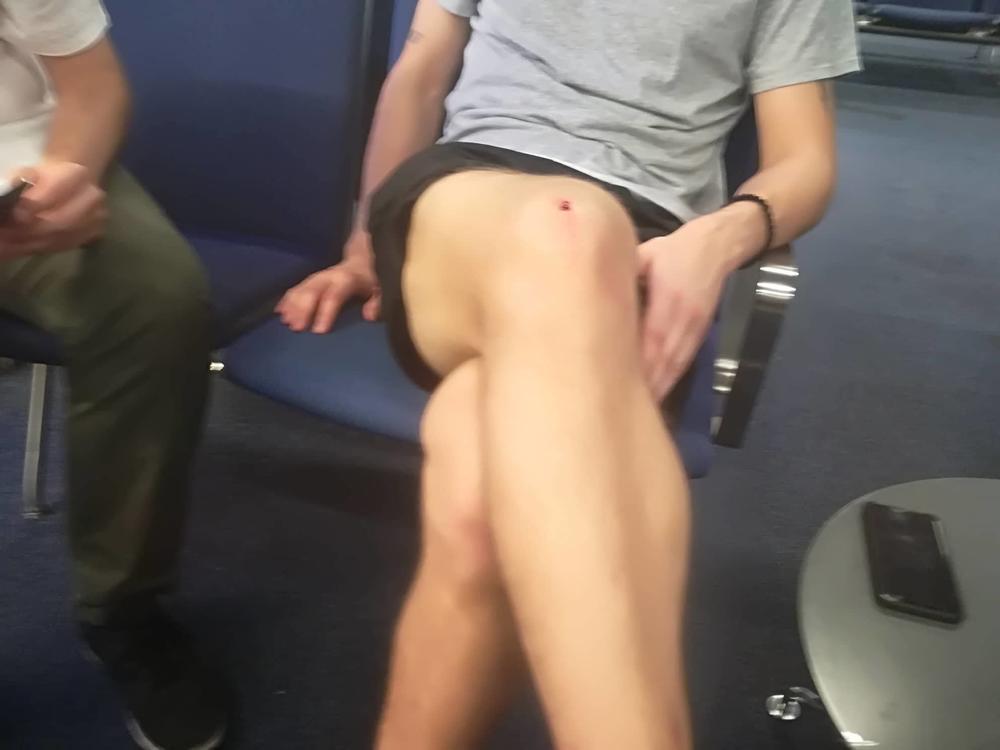 Noge Vladimira Stojkovića posle meča u Danskoj  