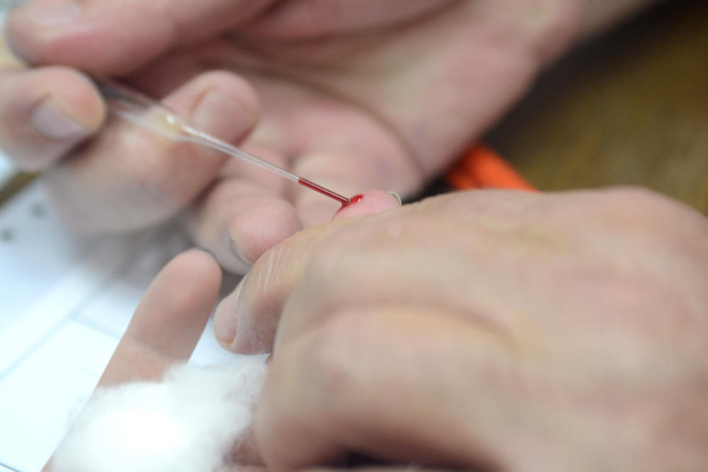 Utvrđivanje krvne grupe  