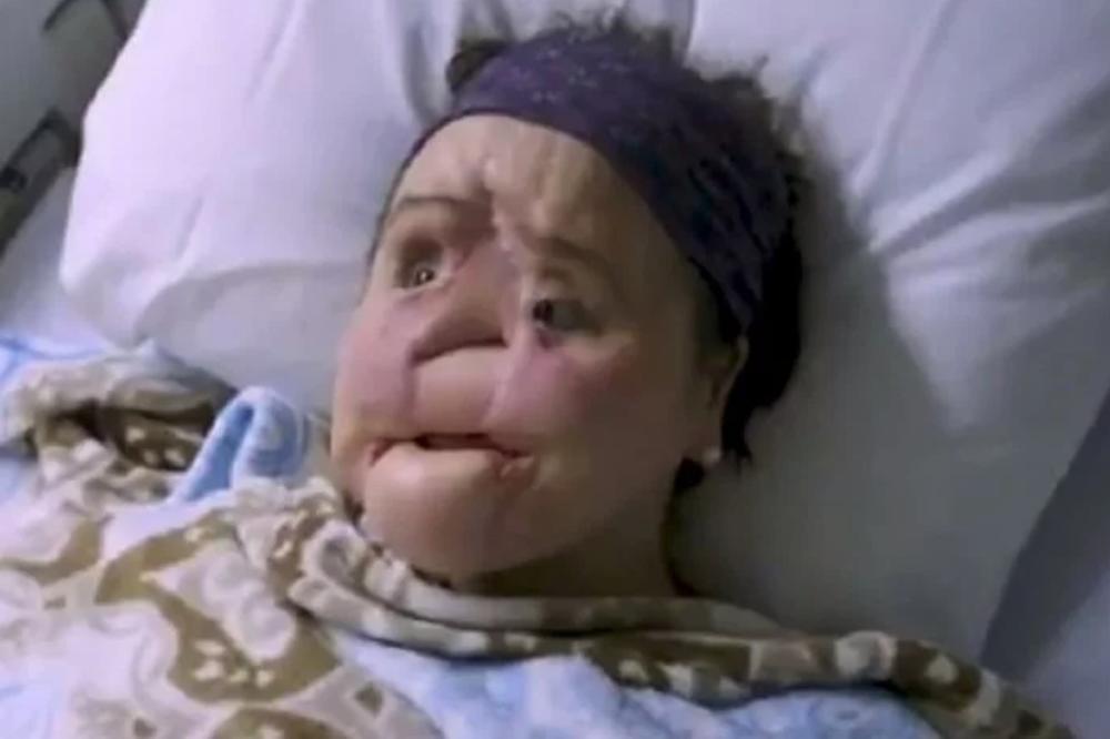 PRE TRI GODINE JE PUCALA SEBI U GLAVU: Sada ima novo lice i novu šansu (FOTO)