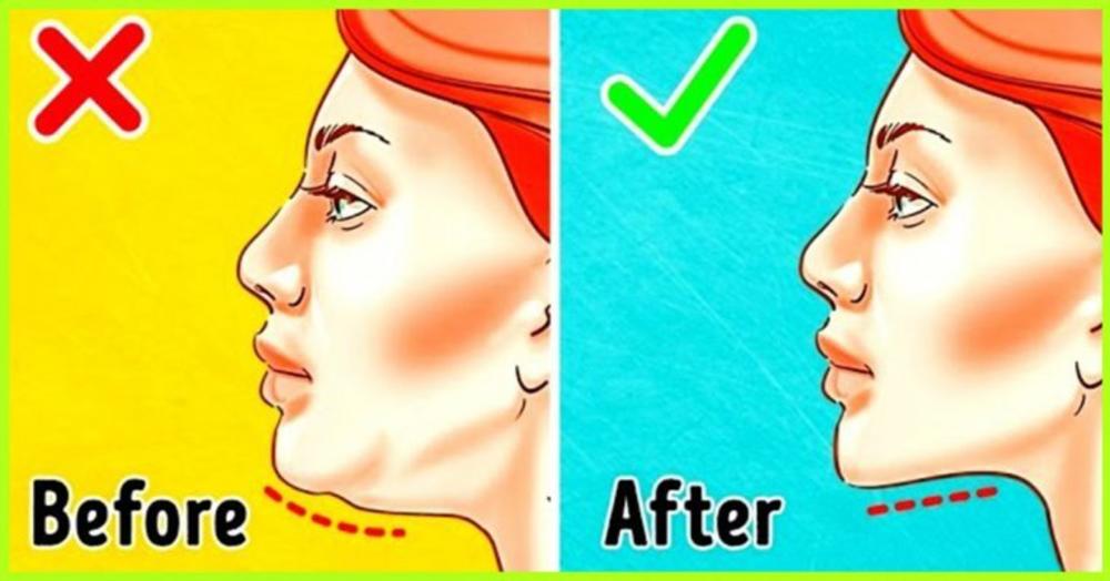 Rešite se podbratka zauvek  