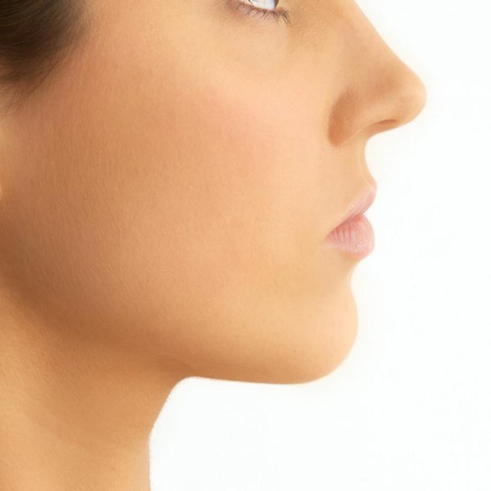 Rešite se podbratka zauvek  