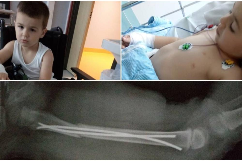 OGNJENA (3) JE UDARIO BICIKLISTA NAKON ČEGA JE DOŽIVEO PRELOM BUTNE KOSTI: Stefanu, samohranom ocu, neophodna je NAŠA pomoć kako bi njegov SIN nastavio lečenje (FOTO)