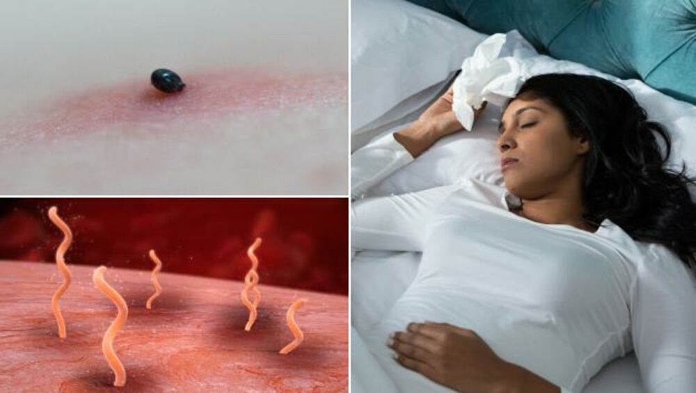 borelija, lajmska bolest