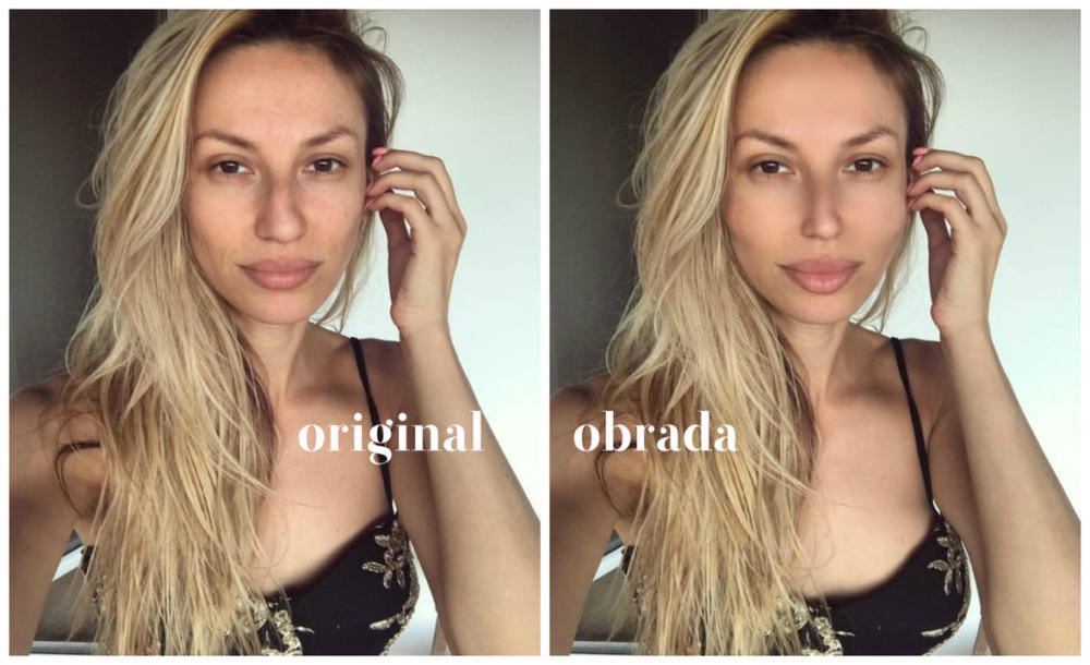 Ovako bi Rada izgledala kada bi uradila treman botoksom i povećala usne  