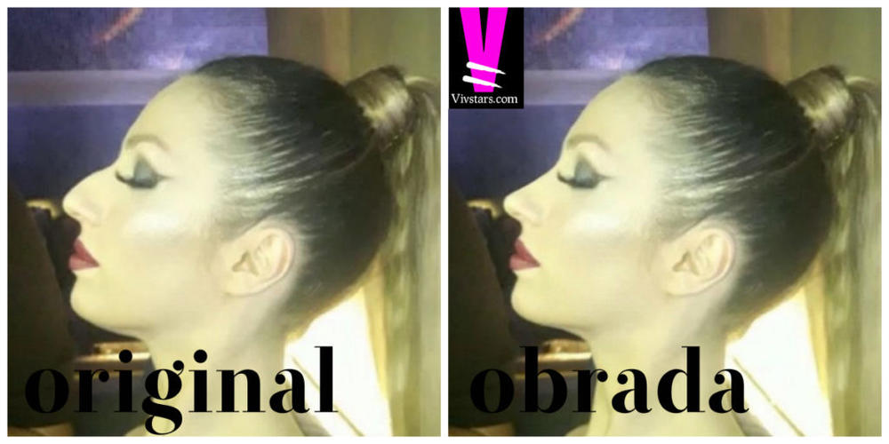 Ovako bi Rada izgledala kada bi operisala nos  