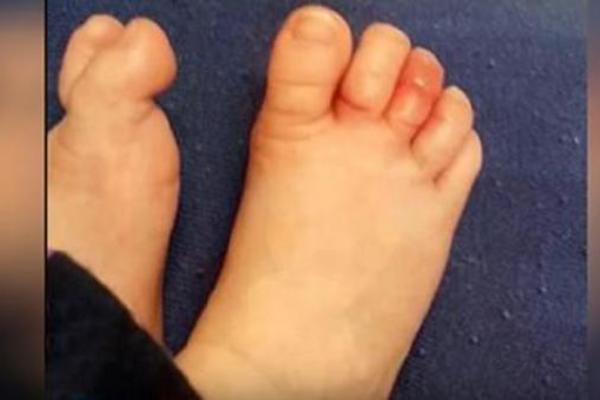 MAJKA JE PRIMETILA DA JE BEBI OTEKAO PRST NA NOZI: Kada je shvatila o čemu je reč, SKAMENILA SE!