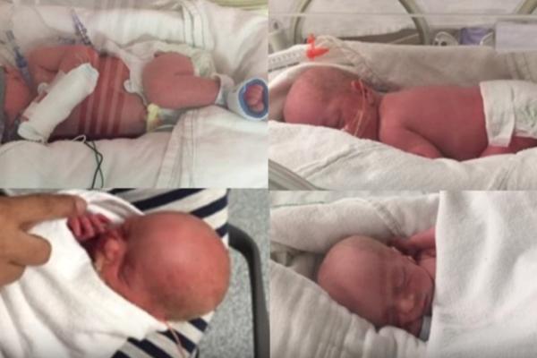 LEKAR URADIO ULTRAZVUK TRUDNICI, OTAC SE UMALO ONESVESTIO: Ovo se dešava u DESET od 70 miliona slučajeva! (VIDEO)