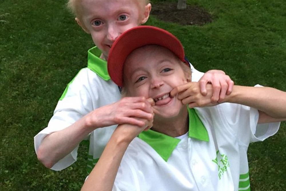 IMAJU 9 I 13 GODINA, A IZGLEDAJU POPUT DVA STARCA: Zbog RETKE BOLESTI, drugačiji su od svojih vršnjaka (FOTO)