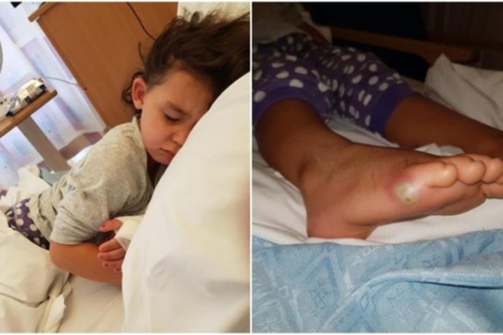 Devojčica se zarazila SMRTONOSNOM SEPSOM nakon što je PROBALA OBUĆU BEZ ČARAPA! Očajna majka upozorava: Infekcija može doći iznenada, čuvajte svoju decu (FOTO)
