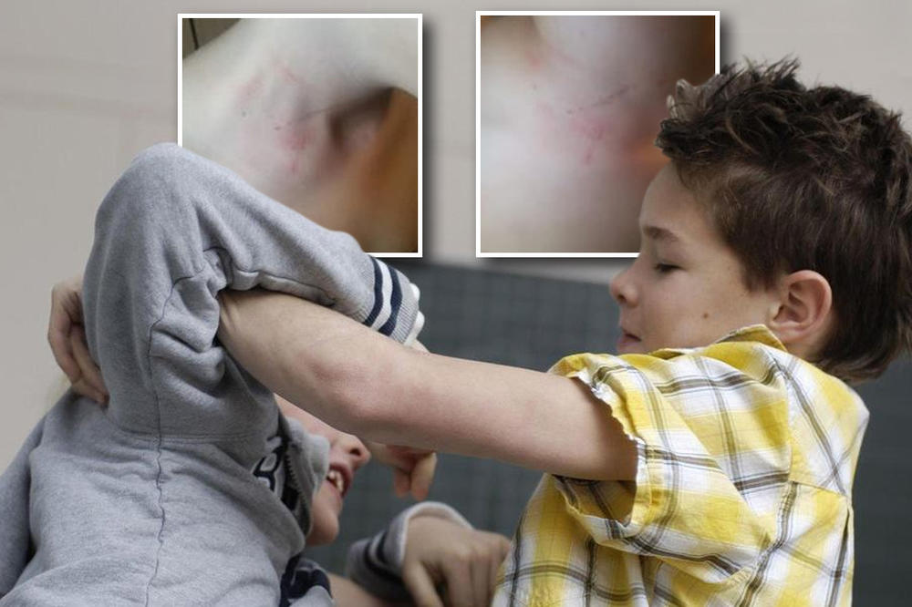 BACIO GA JE NA POD I TUKAO FLAŠOM PO GLAVI! Dečak iz Smederevske Palanke doživeo STRAVIČNO VRŠNJAČKO NASILJE, od stresa mu SKOČIO ŠEĆER! (FOTO)