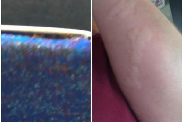 SEDELA JE U AUTOBUSU I ODJEDNOM JE ZASVRBELA RUKA DO PAZUHA: Kada je pogledala sedište, OSTALA JE U ŠOKU! (FOTO)