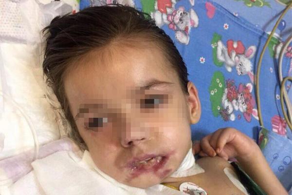 MAJKA IZ BESA ODGRIZLA USNU MENTALNO ZAOSTALOJ ĆERKI: Za malu Katju je čuo ceo svet, a sada je njena priča dobila NAJTUŽNIJI KRAJ! (FOTO)