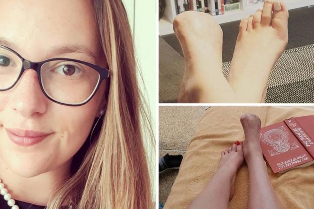 Zbog PEDIKIRA SA RIBICAMA morali su da joj AMPUTIRAJU PRSTE NA NOGAMA!