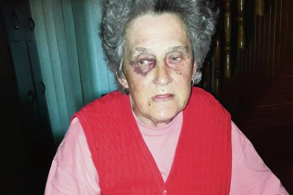 JULIJANU (68) SU PRŽILI PEGLOM, NJENOM MUŽU SLOMILI JAGODIČNU KOST! Porodicu Obradović kod Aleksinca PLJAČKAŠI SU ZVERSKI MALTRETIRALI!