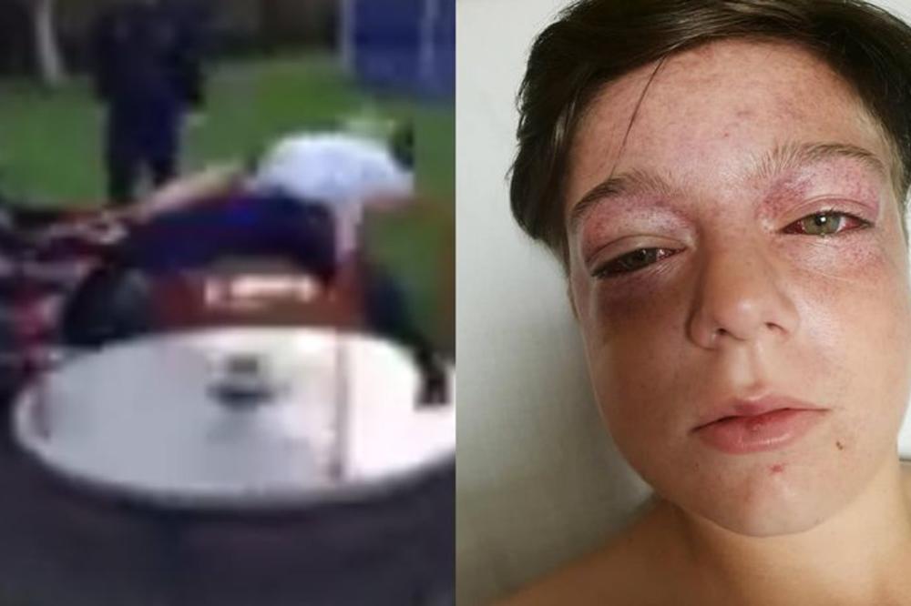 DEČAK (11) POKUŠAO DA NAPRAVI FORU SA JUTJUBA PA SE TEŠKO POVREDIO: Lekari su rekli da su ovakve povrede videli samo kod PILOTA! (VIDEO)
