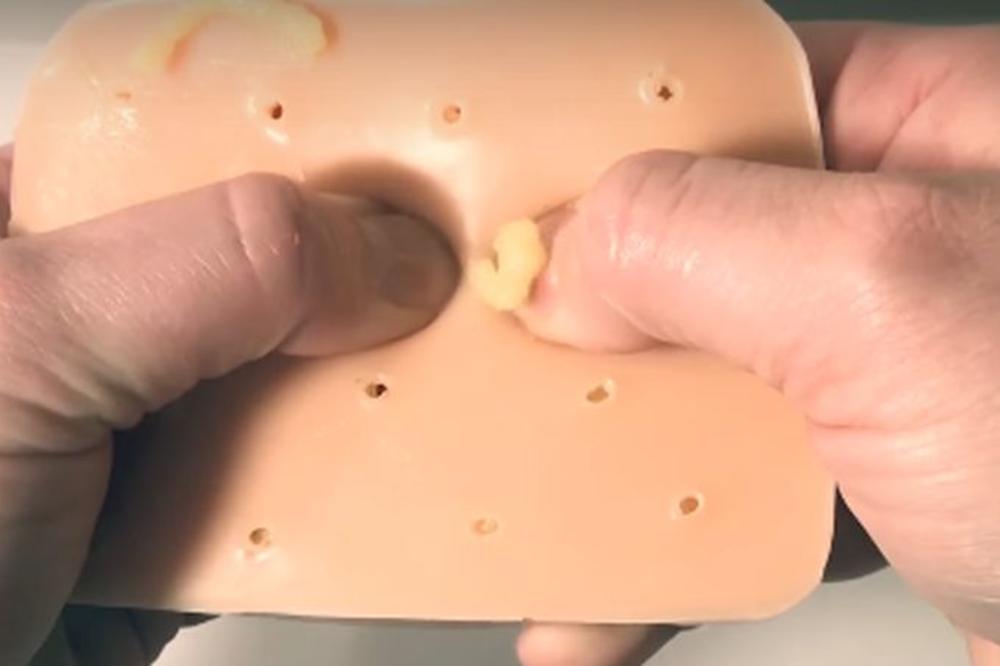 UŽIVAJU U PUCKETANJU BALONČIĆA, ISTISKANJU BUBULJICA... Ove stvari OZBILJNO OPUŠTAJU! (VIDEO)