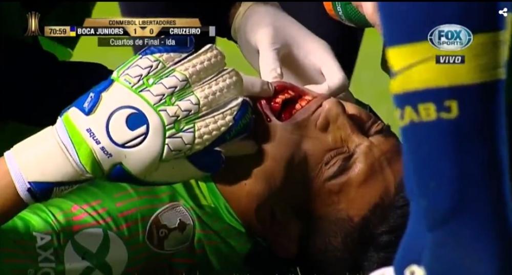 Krv ide iz golmanovih usta  