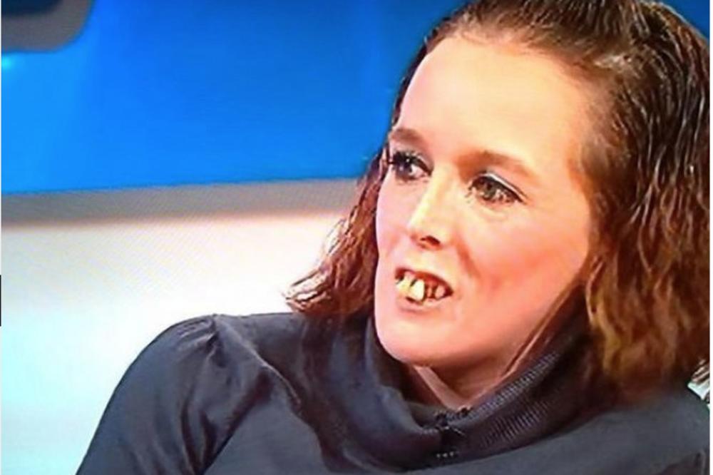 SVI SU JE ZVALI ŽENA SA KONJSKIM ZUBIMA: Sada mogu da se pokriju ušima jer se POTPUNO TRANSFORMISALA! (FOTO)