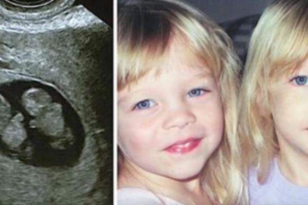 RODILA JE BLIZNAKINJE, POSLE 12 GODINA JEDNA SE RAZBOLELA: Sestra se nije odvajala od nje, a onda se desilo čudo