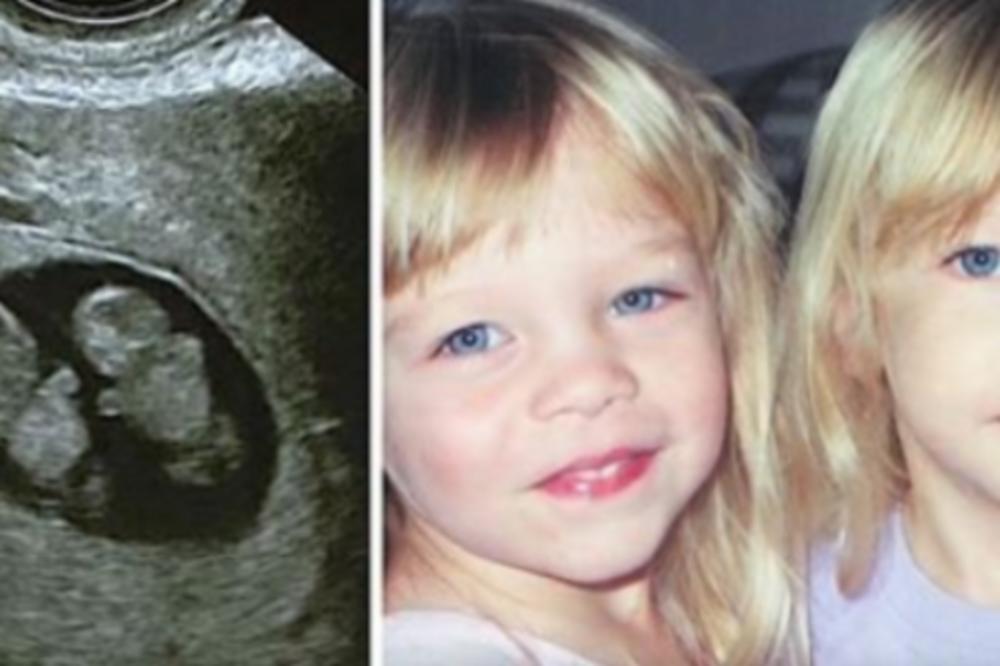 RODILA JE BLIZNAKINJE, POSLE 12 GODINA JEDNA SE RAZBOLELA: Sestra se nije odvajala od nje, a onda se desilo čudo