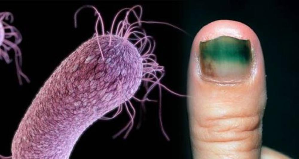 Oporavak je dugačak put  