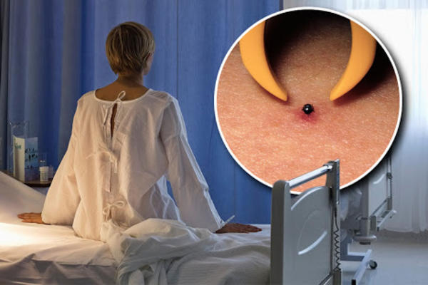 KOD DRŽAVNOG LEKARA ČEKAM 30 DANA, KOD PRIVATNIKA 7 SATI: Dva meseca imam lajmsku bolest i BESNA SAM NA SVE!