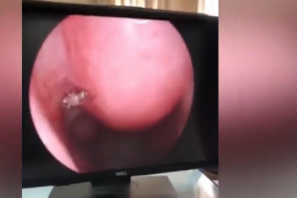 ZAVIRILI SU MU U NOS: Kad su videli šta je unutra, šokirali su se! (VIDEO)