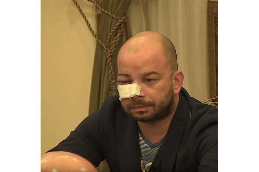 DRAMA U PAROVIMA: Ja jesam izazvao Luku na neki način, ali ne da ovako zverski prođem!Evo kako Mili izgleda!(FOTO)