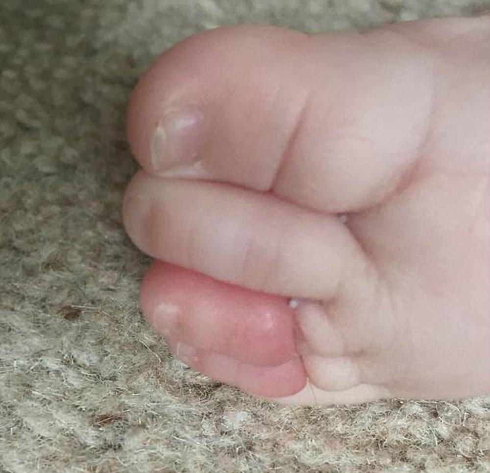 Zbog ovoga je mogla da ostane bez prsta  