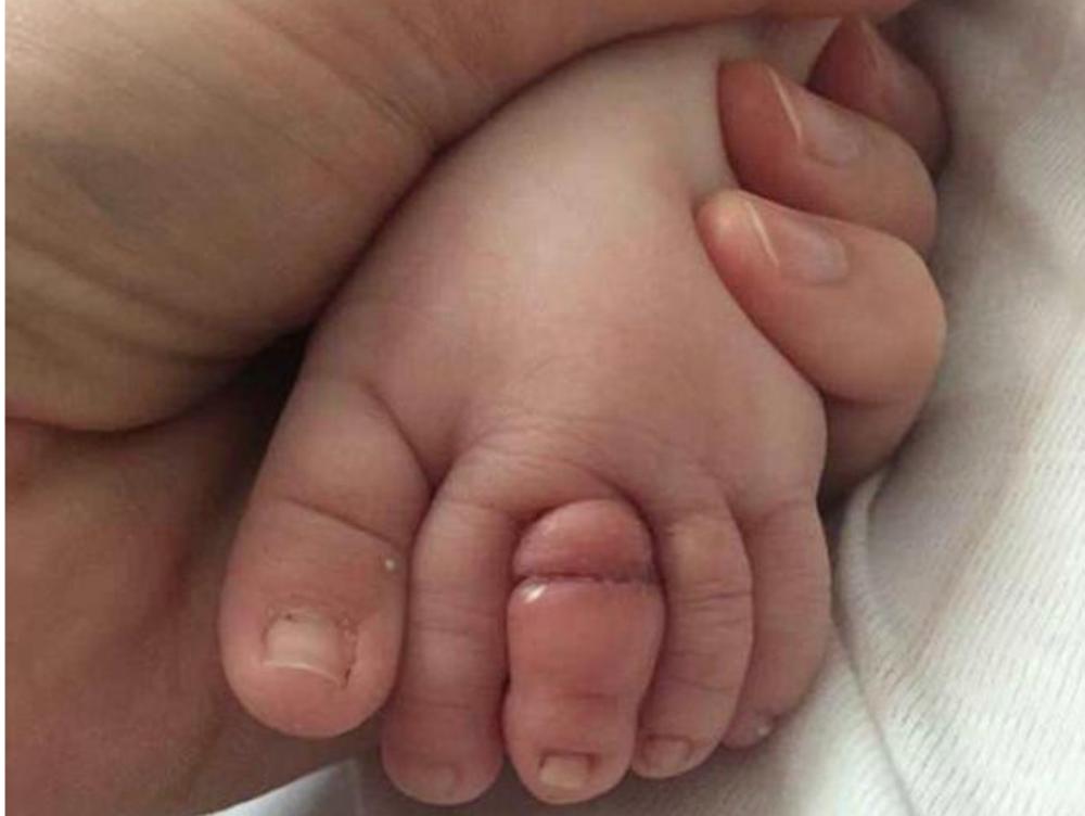 Zbog ovoga je mogla da ostane bez prsta  