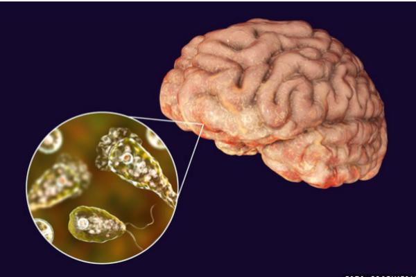 HOROR! Ameba koja 'jede' mozak pronađena u bazenima, jezerima i rekama