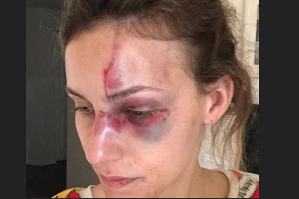 DEČKO JE PRETUKAO ZBOG FOTOGRAFIJE NA INSTAGRAMU: Bogati tatin sin odmah je pušten iz zatvora!